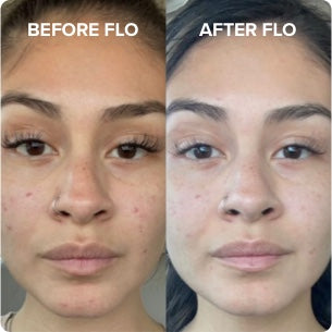 Before After